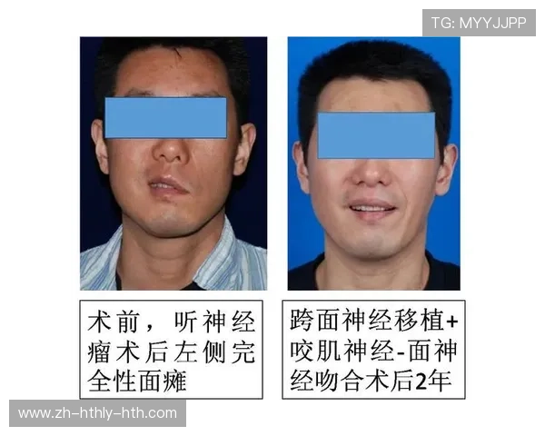 足球电刺激治疗是否加速伤后神经恢复及身体调节能力